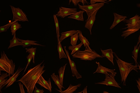 印度麂，成纖維細胞