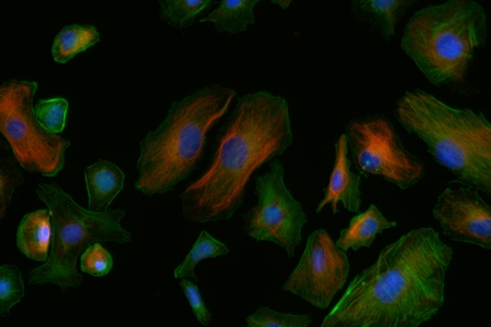 水貂子宮上皮細胞子宮內膜