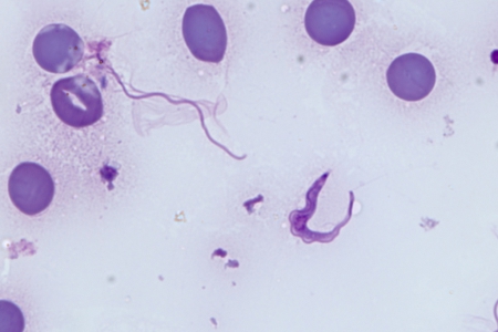 人類血塗片中的布氏岡比亞錐蟲寄生蟲:：吉姆薩染色。使用蔡司 Plan-Apochromat 63x/1.4 油浸物鏡拍攝。