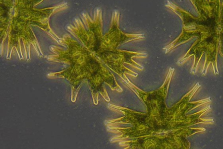 Micrasterias radiata(藻類)，明場對比