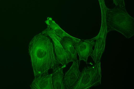 U20S細胞，GFP染色，螢光對比劑