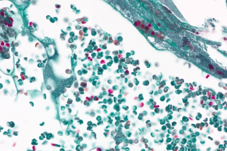 血管，透射光明場