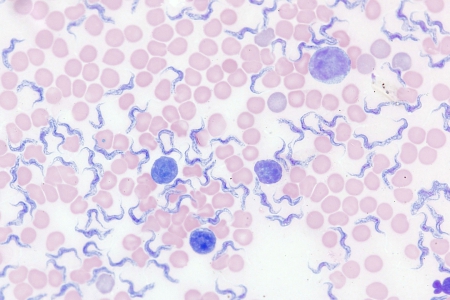 血跡、Giemsa染色、透射光明場