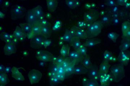 已鑑定的人體細胞被分離並運送至PCR管