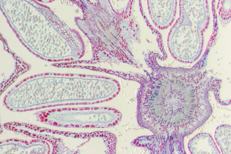 透過反射光取得罌粟籽，明亮視野