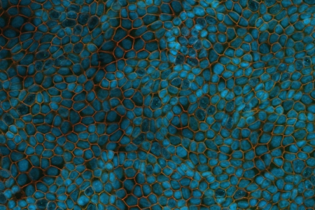 極化 CACO-2 細胞： 過濾生長兩週。標本由德國 WWU 明斯特醫學生物化學研究所炎症分子生物學中心的 C. Hartmann 和 K. Ebnet 提供。