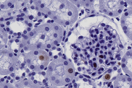 大鼠腎臟切片：Ki-67染色。使用蔡司 Plan-Apochromat 40×/1.4 油浸物鏡成像。