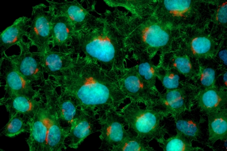 固定培養的HeLa細胞    藍色：DNA （DAPI），綠色：F-肌動蛋白（鬼筆環肽-Alexa Fluor 488），紅色：反式高爾基體網絡（TGN-Alexa Fluor 561）
