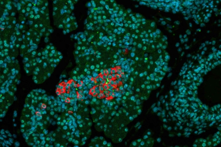 小鼠胰臟組織 胰臟胰島上染色DNA（藍色）、胰島素（綠色）和胰高血糖素（紅色）。 樣品提供：A. Feuchtinger，亥姆霍茲慕尼黑中心，德國