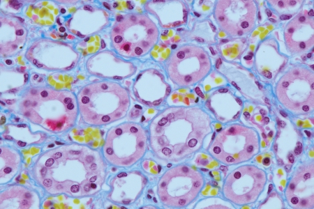 人纖維蛋白腎： 三色染色。物鏡：蔡司 Plan-Apochromat 63x/1.4 油