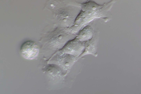 透射光PlasDIC中的細胞