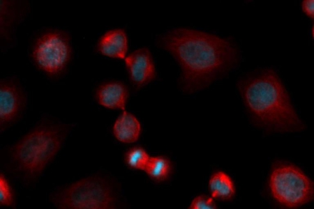 HeLa 京都細胞，多通道螢光影像