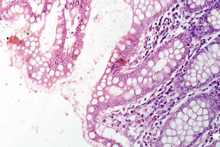 腸道、HE染色、明場對比劑