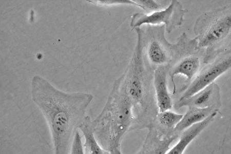 U2OS 細胞相位對比，透射光影像，目標：LD A-Plan 40x/0.55 pH 1