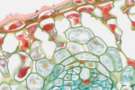 槲寄生葉  使用蔡司 Axio Imager 和 Axiocam 305 彩色獲取