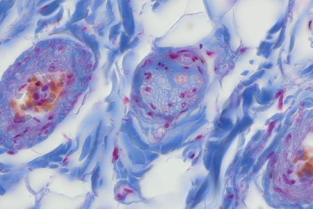 週邊神經代表性影像，透射光明場