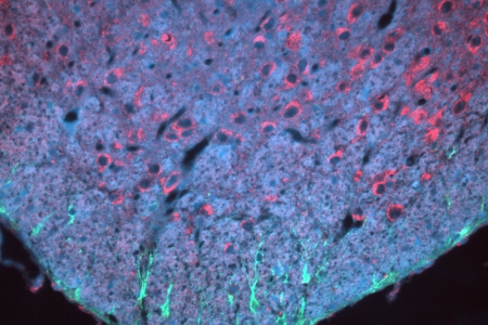 小鼠腦切片抗體染色 細胞核（藍色）、星形膠質細胞（綠色）、細胞角蛋白（紅色），使用蔡司 Axio 成像儀獲取，物鏡：EC Plan-NEOFLUAR 20x / 0.50
