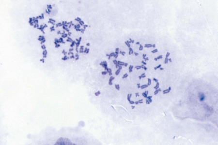 染色體標本（人類）
