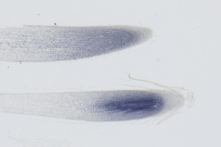 明視野中的根尖