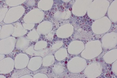 人類骨髓在明場中的代表性圖像