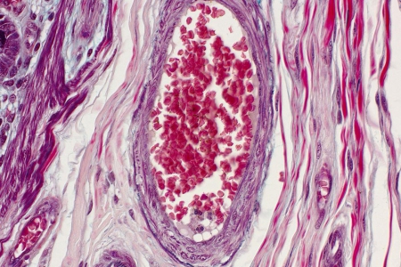 明場中人體血管的代表性圖像
