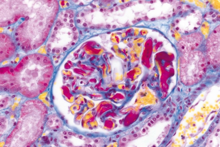 腎臟組織（人類）